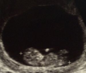 10366279_835880976424152_1132417065547290305_n