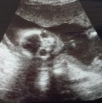2014-08-28 14.52.19